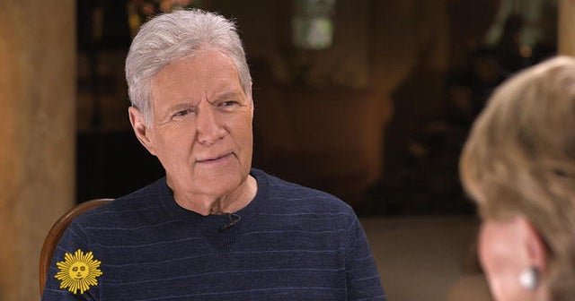 Preview: Alex Trebek on chemotherapy and losing his hair