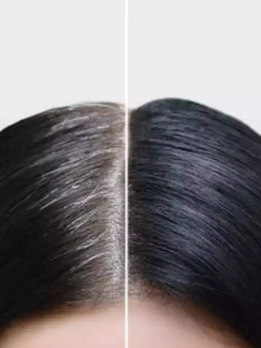 9 daily habits that can delay greying of hair