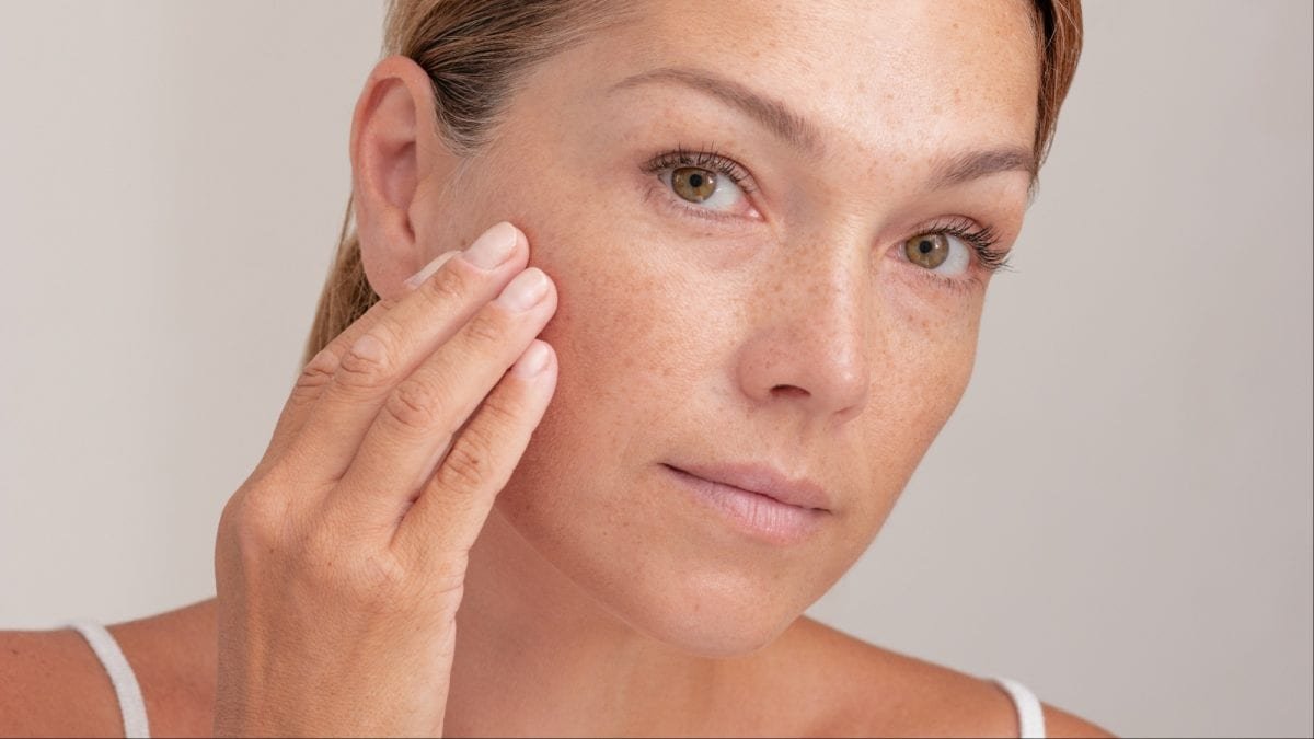 How to Choose the Right Sunscreen for Acne-Prone Skin