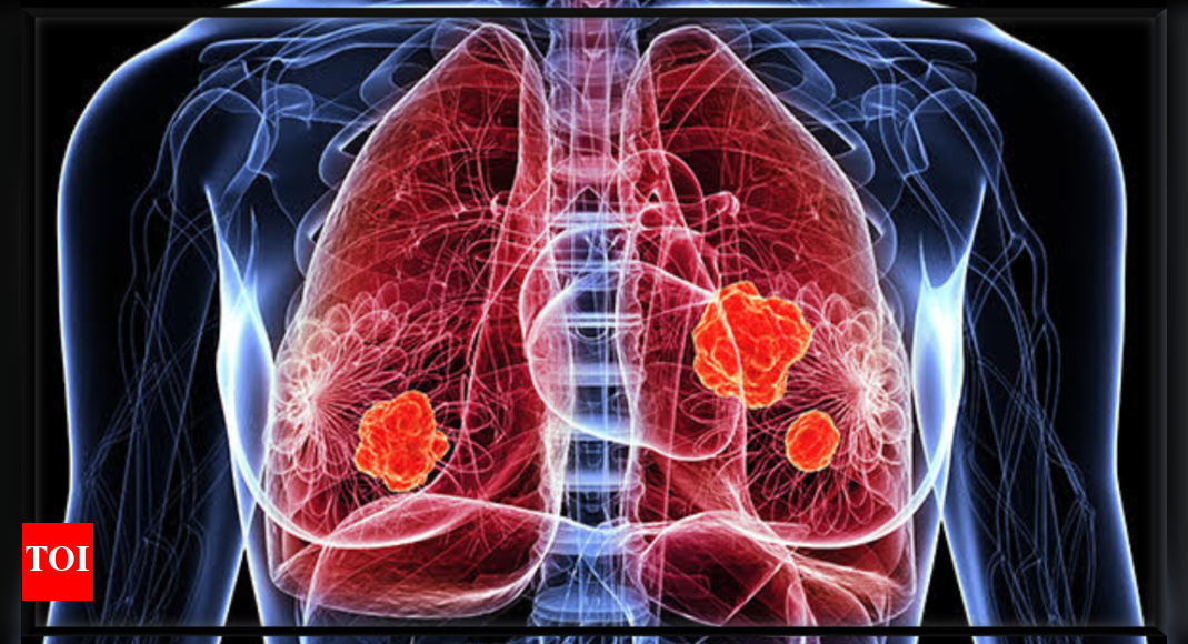 Lung Cancer Symptoms: 6 early symptoms of Lung Cancer that are easily ignored |