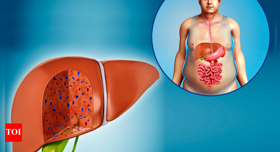 Fatty Liver: 5 drinks that can cure fatty liver |