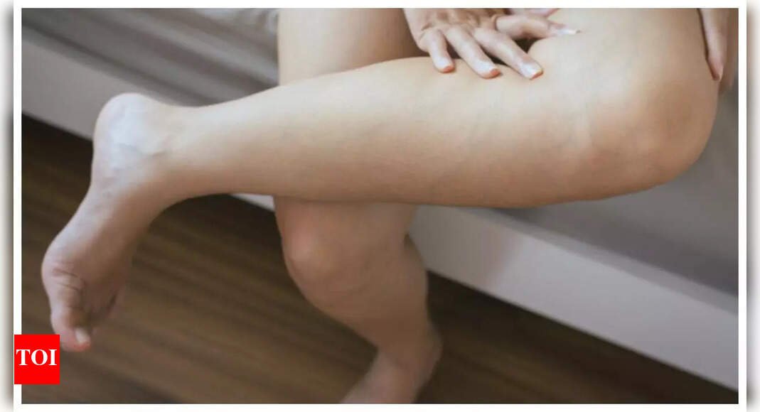 6 hidden deficiencies that legs can point to