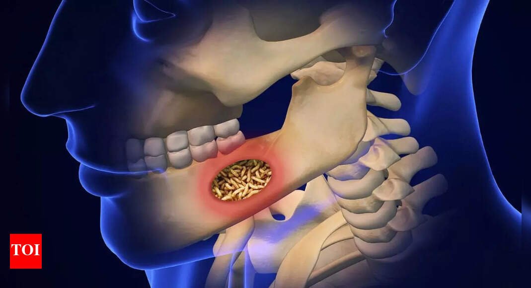 What is Mouth Larvae: Know its causes, symptoms, prevention strategies, and treatment |