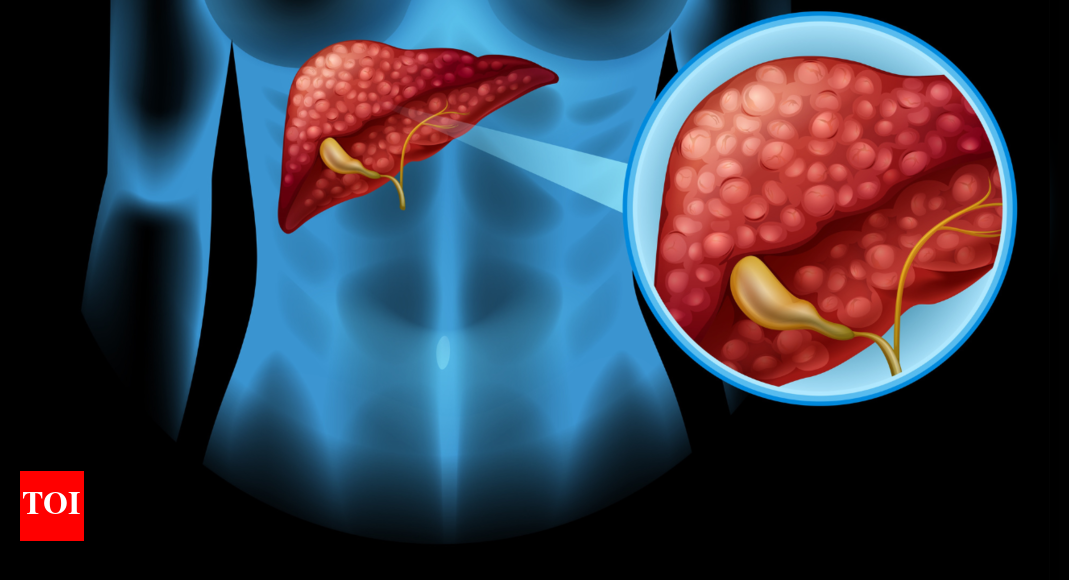 3 common foods that are secretly harming the liver