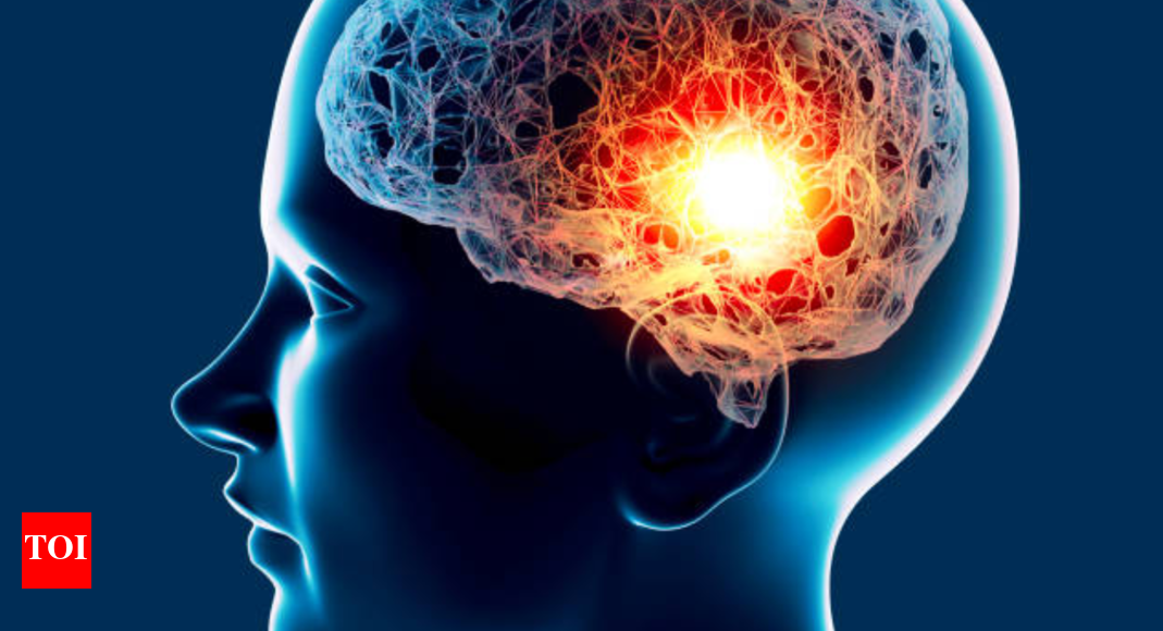 Brain aneurysms are silent killers—here's why