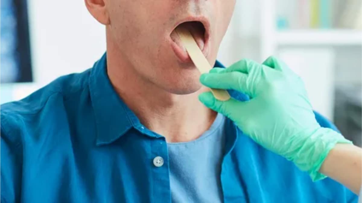 The Hidden Link Between STIs and Male Cancers: What Every Man Should Know | Health and Fitness News