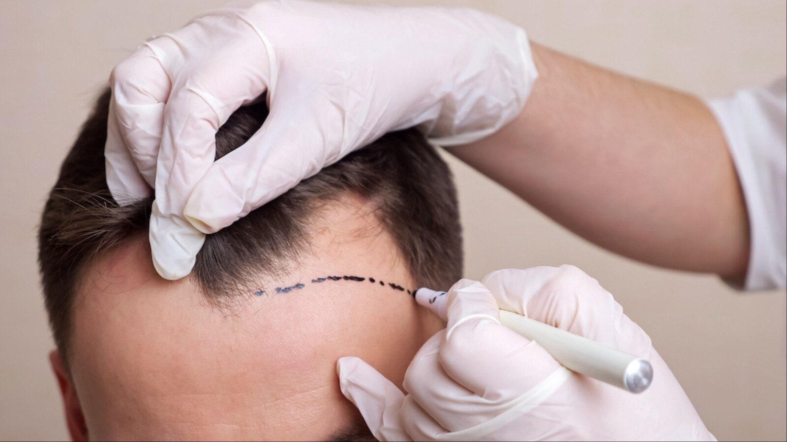 Expert Reveals Why Informed Decisions Are Needed More Than Ever In Cosmetic Wellness
