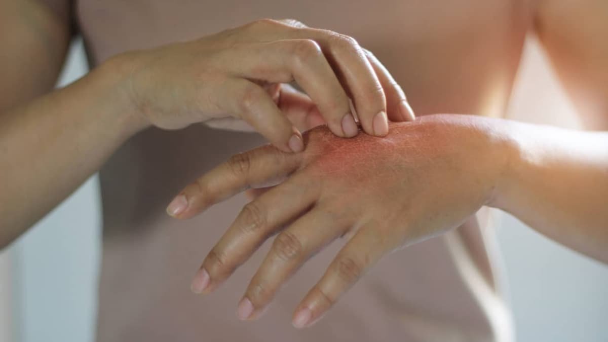 Skin Cancer Red Flags: Symptoms That Call For Immediate Attention