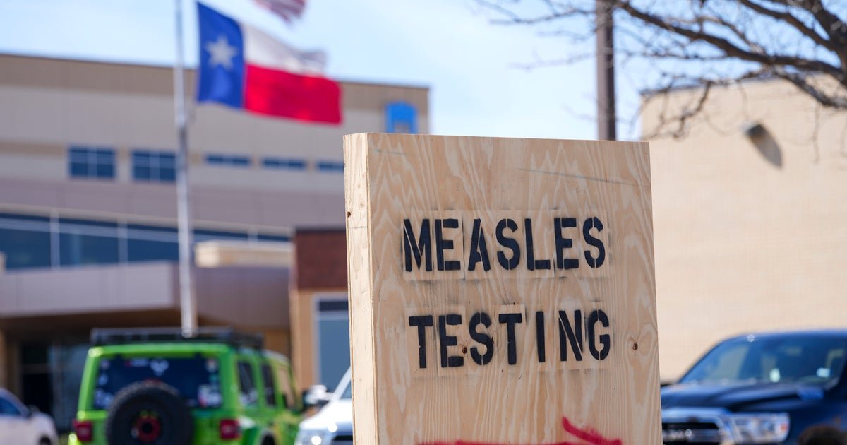 Map shows more than 1,100 measles cases across U.S. as outbreak grows
