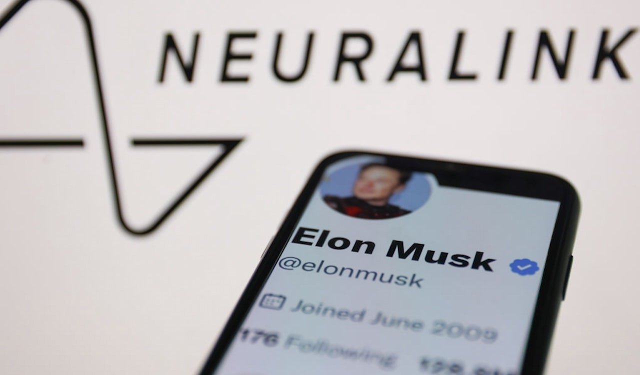 First Neuralink brain implant patient thanks Elon Musk for life-changing tech