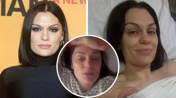 Jessie J clarifies 'misunderstanding' about her cancer surgery