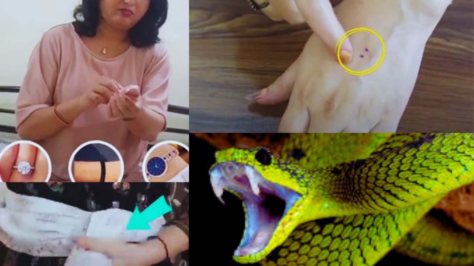 A Snake Bite Doesn’t Have To Be Fatal If You Do These Things Immediately