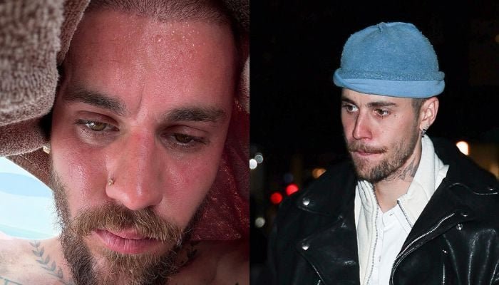 Justin Bieber’s latest selfie fuels talk of health crisis