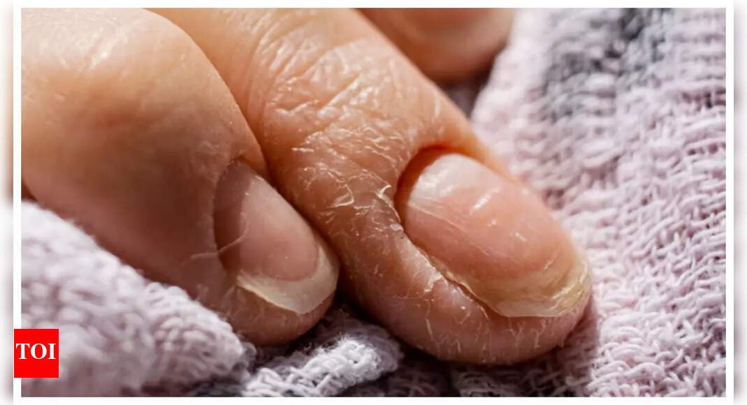 10 hidden warnings that our nails give about the body's health