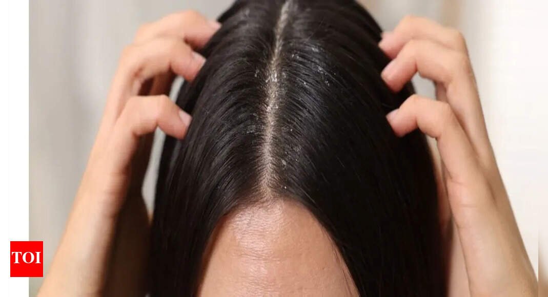 Dandruff vs Dry Scalp: What causes them, and how to choose the right treatment |