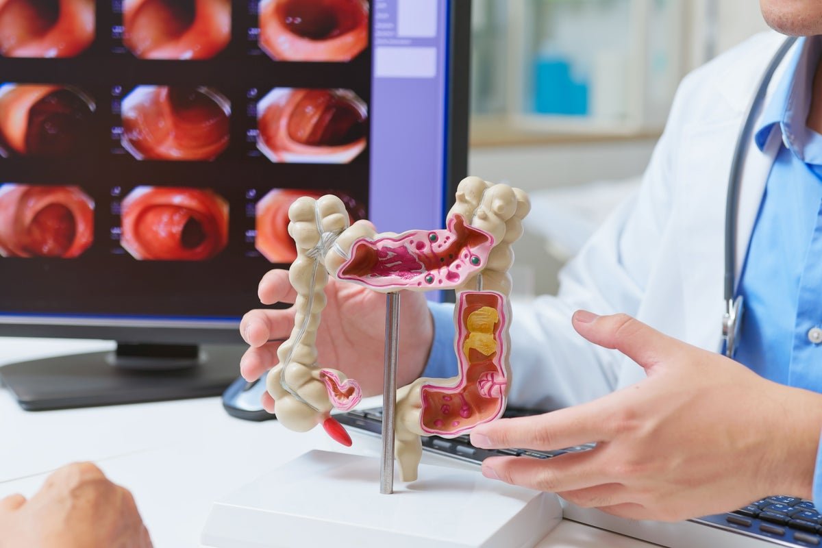How a bowel cancer examination revealed AI’s negative impact on doctors